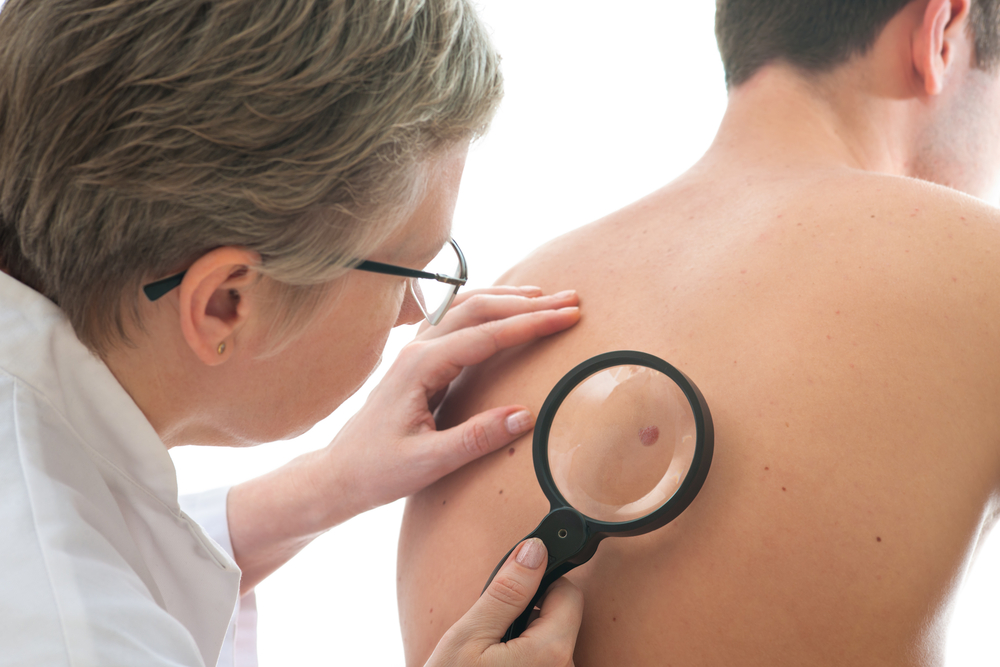 Skin Cancer Screening